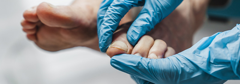 Latex gloved hands examine a patient's foot.